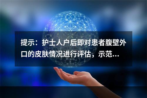 提示：护士人户后即对患者腹壁外口的皮肤情况进行评估，示范指导