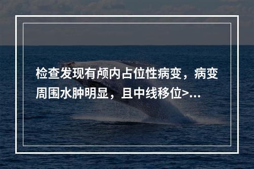 检查发现有颅内占位性病变，病变周围水肿明显，且中线移位>0.