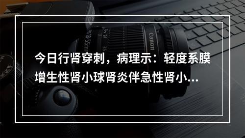 今日行肾穿刺，病理示：轻度系膜增生性肾小球肾炎伴急性肾小管坏