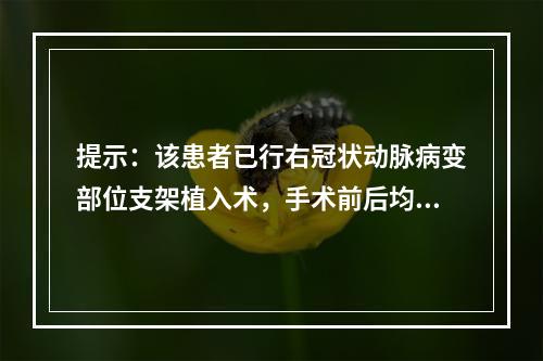 提示：该患者已行右冠状动脉病变部位支架植入术，手术前后均需服