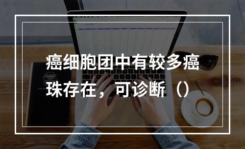 癌细胞团中有较多癌珠存在，可诊断（）
