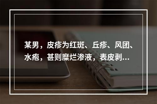 某男，皮疹为红斑、丘疹、风团、水疱，甚则糜烂渗液，表皮剥脱；