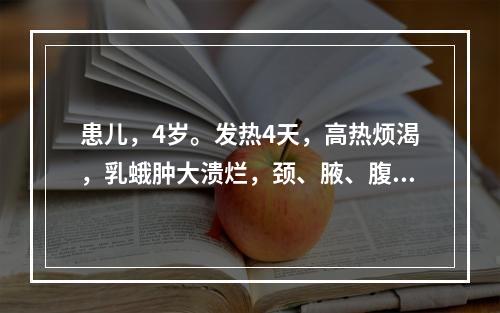 患儿，4岁。发热4天，高热烦渴，乳蛾肿大溃烂，颈、腋、腹股沟