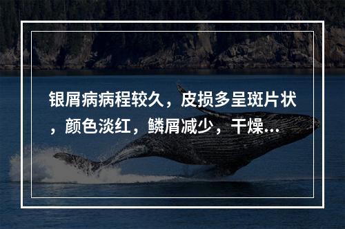 银屑病病程较久，皮损多呈斑片状，颜色淡红，鳞屑减少，干燥皲裂