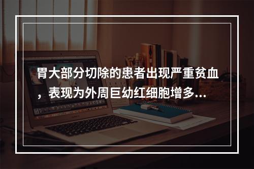 胃大部分切除的患者出现严重贫血，表现为外周巨幼红细胞增多，其