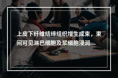 上皮下纤维结缔组织增生成束，束间可见淋巴细胞及浆细胞浸润，毛