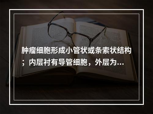 肿瘤细胞形成小管状或条索状结构；内层衬有导管细胞，外层为肌上