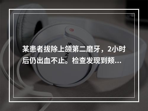 某患者拔除上颌第二磨牙，2小时后仍出血不止。检查发现到颊侧牙