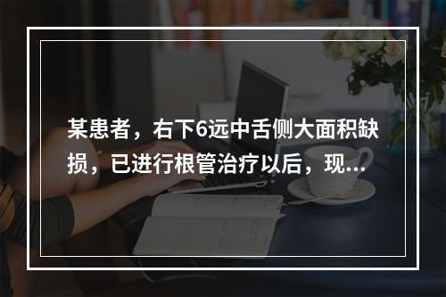 某患者，右下6远中舌侧大面积缺损，已进行根管治疗以后，现要求