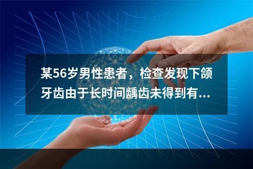 某56岁男性患者，检查发现下颌牙齿由于长时间龋齿未得到有效治