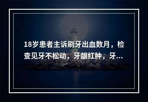 18岁患者主诉刷牙出血数月，检查见牙不松动，牙龈红肿，牙周探