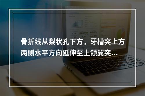 骨折线从梨状孔下方，牙槽突上方两侧水平方向延伸至上颌翼突缝称