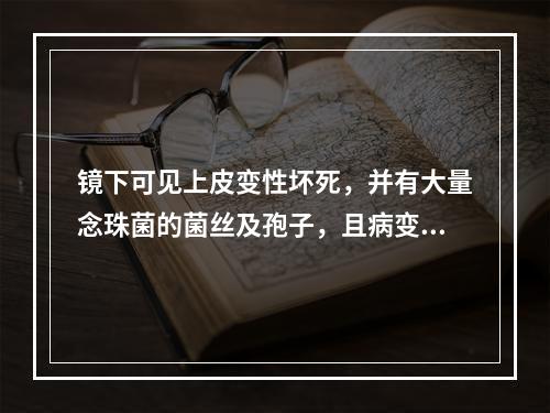 镜下可见上皮变性坏死，并有大量念珠菌的菌丝及孢子，且病变可见