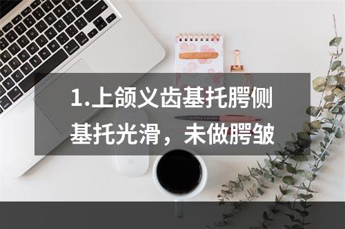 1.上颌义齿基托腭侧基托光滑，未做腭皱