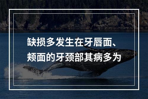 缺损多发生在牙唇面、颊面的牙颈部其病多为