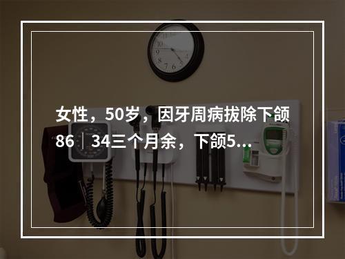 女性，50岁，因牙周病拔除下颌86│34三个月余，下颌5│无