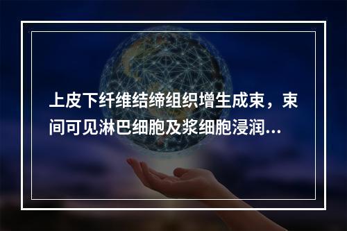 上皮下纤维结缔组织增生成束，束间可见淋巴细胞及浆细胞浸润，毛