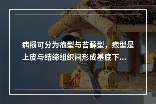 病损可分为疱型与苔藓型，疱型是上皮与结缔组织间形成基底下疱，