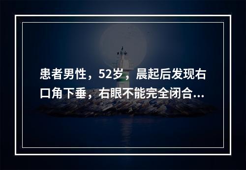 患者男性，52岁，晨起后发现右口角下垂，右眼不能完全闭合，检