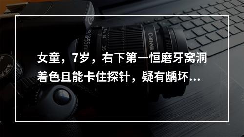 女童，7岁，右下第一恒磨牙窝洞着色且能卡住探针，疑有龋坏，医