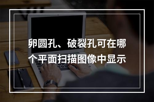 卵圆孔、破裂孔可在哪个平面扫描图像中显示