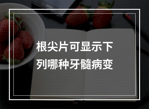 根尖片可显示下列哪种牙髓病变