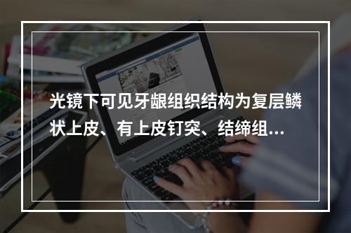 光镜下可见牙龈组织结构为复层鳞状上皮、有上皮钉突、结缔组织常