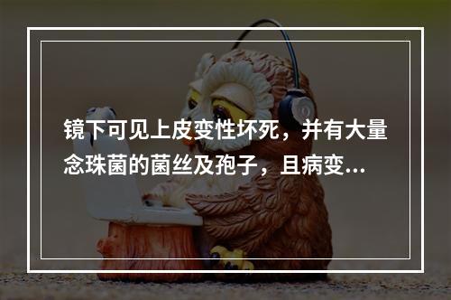 镜下可见上皮变性坏死，并有大量念珠菌的菌丝及孢子，且病变可见