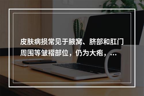 皮肤病损常见于腋窝、脐部和肛门周围等皱褶部位，仍为大疱，尼氏