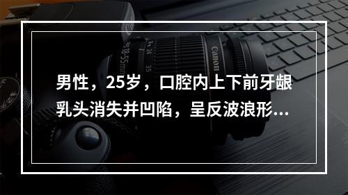 男性，25岁，口腔内上下前牙龈乳头消失并凹陷，呈反波浪形，牙