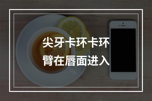 尖牙卡环卡环臂在唇面进入