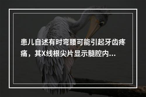 患儿自述有时弯腰可能引起牙齿疼痛，其X线根尖片显示髓腔内有阻