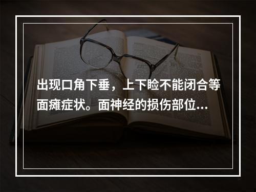 出现口角下垂，上下睑不能闭合等面瘫症状。面神经的损伤部位位于