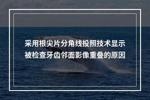 采用根尖片分角线投照技术显示被检查牙齿邻面影像重叠的原因