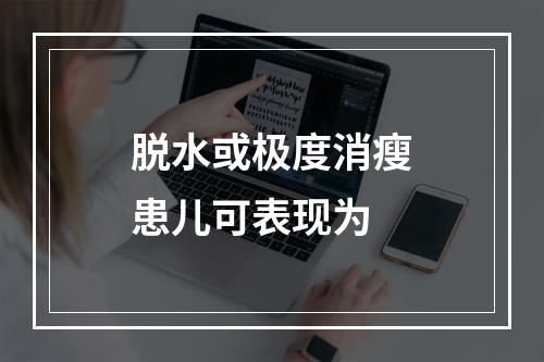 脱水或极度消瘦患儿可表现为