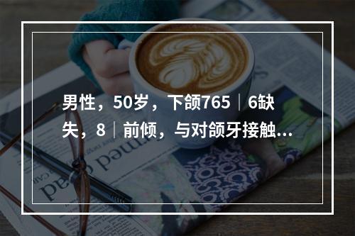 男性，50岁，下颌765│6缺失，8│前倾，与对颌牙接触不良