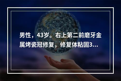 男性，43岁。右上第二前磨牙金属烤瓷冠修复，修复体粘固3天，