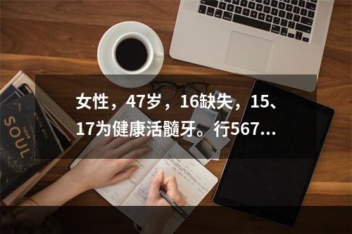 女性，47岁，16缺失，15、17为健康活髓牙。行567金属