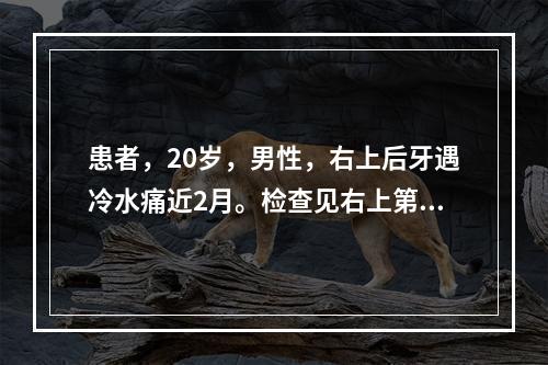 患者，20岁，男性，右上后牙遇冷水痛近2月。检查见右上第一磨