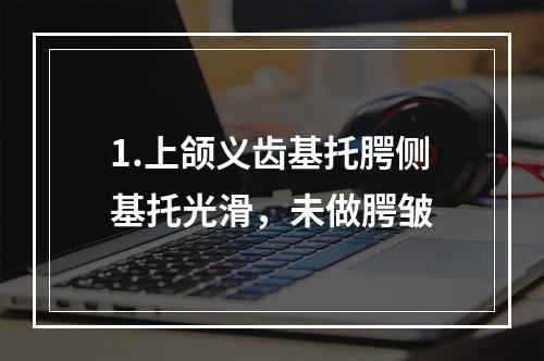 1.上颌义齿基托腭侧基托光滑，未做腭皱