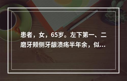 患者，女，65岁。左下第一、二磨牙颊侧牙龈溃疡半年余，似菜花