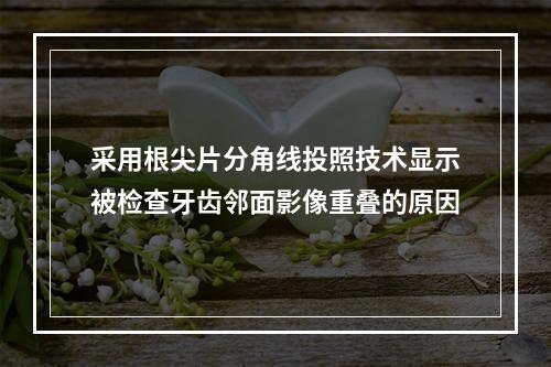 采用根尖片分角线投照技术显示被检查牙齿邻面影像重叠的原因