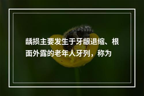 龋损主要发生于牙龈退缩、根面外露的老年人牙列，称为