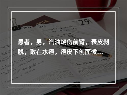 患者，男，汽油烧伤前臂，表皮剥脱，散在水疱，疱皮下创面微湿，