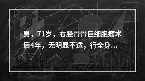 男，71岁，右胫骨骨巨细胞瘤术后4年，无明显不适，行全身骨显