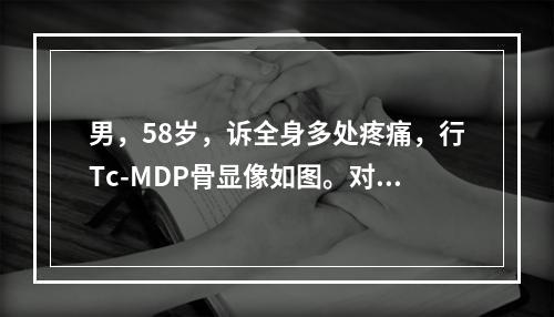 男，58岁，诉全身多处疼痛，行Tc-MDP骨显像如图。对此影