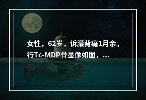 女性，62岁，诉腰背痛1月余，行Tc-MDP骨显像如图，可能