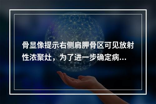 骨显像提示右侧肩胛骨区可见放射性浓聚灶，为了进一步确定病变部