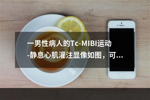 一男性病人的Tc-MIBI运动-静息心肌灌注显像如图，可能的