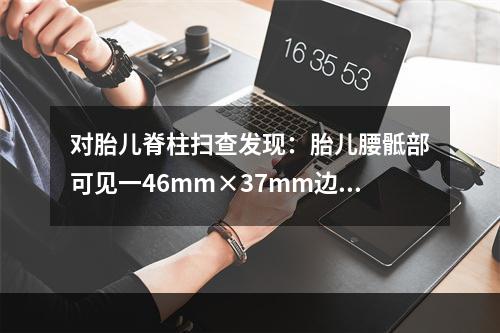 对胎儿脊柱扫查发现：胎儿腰骶部可见一46mm×37mm边界清